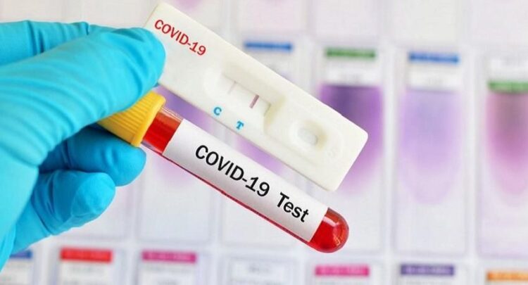 Anggota DPRD : Rapid Tes Dilakukan Dalam Rangka Pencegahan Penyebaran COVID